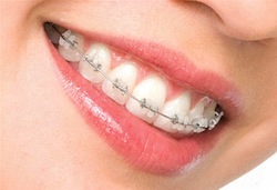 surgical orthodontics